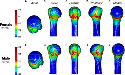 Morphology and novel classification of proximal humeral fractures